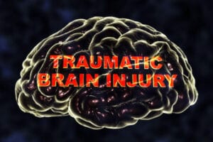 Medical marijuana for treating traumatic brain injury